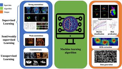 Applications of artificial intelligence-powered prenatal diagnosis for congenital heart disease